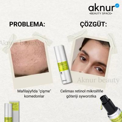 Celimax komedonly ýüz üçin retinol mikroiňňe göteriji syworotka