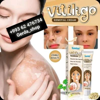 Витилиго мазь