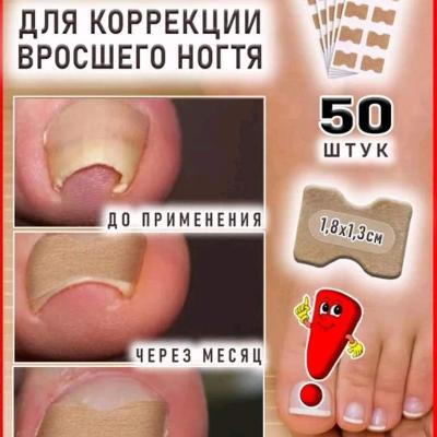 От вросшего ногтя